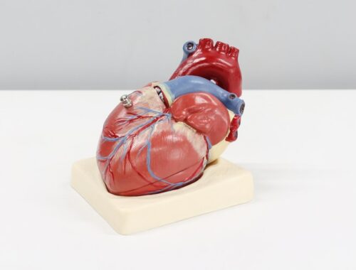 Cipa Assay Testing: An Aid for Cardiac Safety?